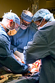 Bowel surgery