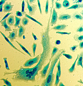 PC-3 human prostate cancer cells