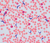 Trypanosoma Protozoa in blood,LM