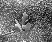 SEM of rubella virus erupting from a cell surface