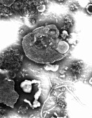 TEM of damaged measles virus; nucleocapsid visible
