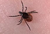 Ixodes spec. (tick) on skin, dangerous carrier of Lyme disease and meningitis