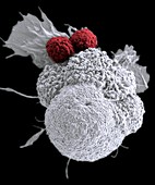T cells attacking cancer cell, SEM