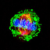 Dividing breast cancer cell