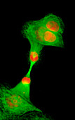 Cells dividing, light micrograph