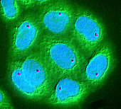 Fluorescence mapping of an oncogene