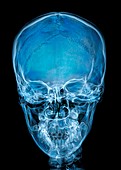 Human skull, frontal X-ray