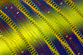 Desmids and Spirogyra algae, micrograph