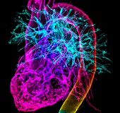 Human heart and great vessels, 3D CT scan