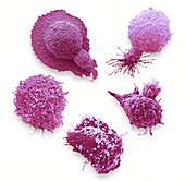 Cells from the most common male cancers, SEM