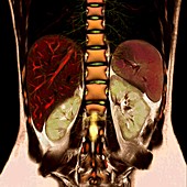 Abdominal organs and spine, MRI scan