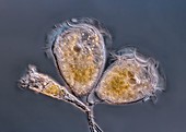 Campanella protozoa, light micrograph