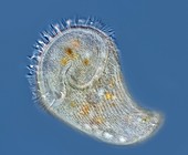 Stentor protozoan, light micrograph