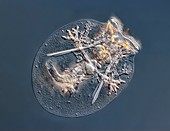 Testudinella rotifer, light micrograph