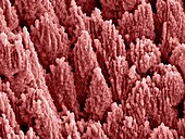 Nanostructures on titanium, SEM