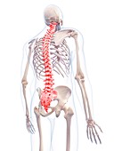 Human spinal pain, illustration