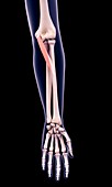 Arm muscle, illustration