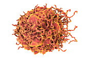 Colon cancer cell, illustration