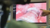 Larynx surgery on a monitor