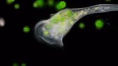 Stentor protozoan feeding on green algae