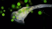 Stentor protozoan feeding on green algae