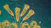 Epistylis ciliates, light microscopy