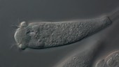 Epistylis ciliate, light microscopy