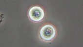 Mast cell degranulation, light microscopy