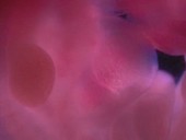 Rat embryo heart, light microscopy