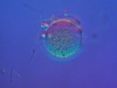 Sperm fertilising ovum, light microscopy