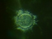 Sperm fertilising ovum, light microscopy