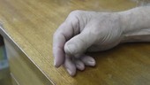 Parkinson's disease hand tremor