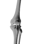 The Knee Bones, artwork