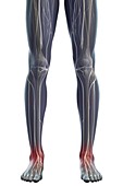 Nerves of the Legs, artwork