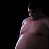 Obesity, artwork