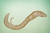 Schistosoma Parasite Worm, artwork