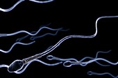 Human Sperm, artwork