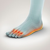 Athlete's Foot, artwork