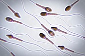 Human Sperm, artwork