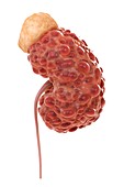 Polycystic Kidney, artwork