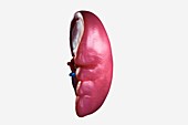 Human Spleen, artwork