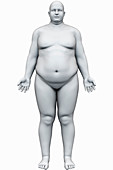 Obesity, illustration