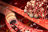 Blood vessel formation, illustration