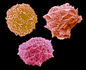 The common childhood cancers, SEM