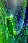 Desmid on sphagnum moss, light micrograph
