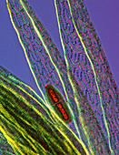 Desmid on sphagnum moss, light micrograph