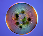Testate amoeba, light micrograph