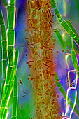Diatoms and Cladophora algae, light micrograph