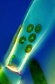 Diatoms and Cladophora algae, light micrograph