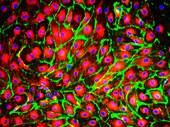 Dermal endothelial cells, fluorescence light micrograph